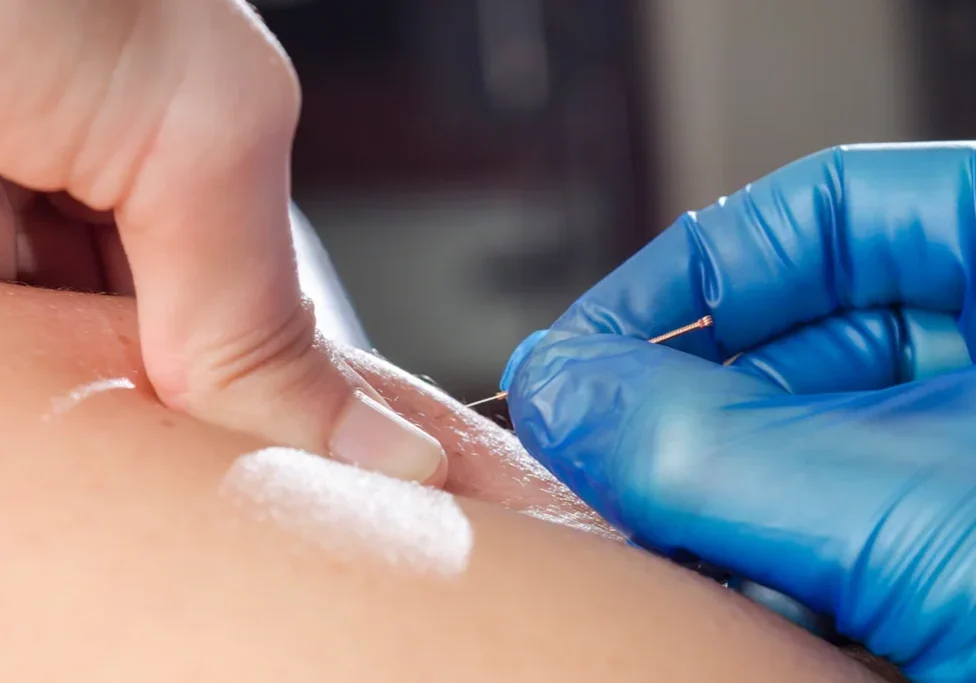 A person is getting their finger marked with blue gloves.